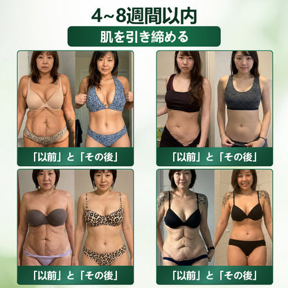 💥 BOMSTF®＆NAD+ 8-in-1 ナノ強化フォーミュラ【アップグレード版】内臓脂肪 / 肥満 / 糖尿病 / 睡眠時無呼吸 / 関節ケア / 肌のたるみ 集中サポート📦