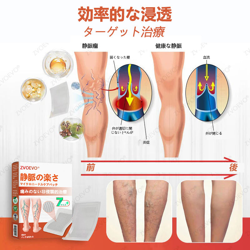 ☘️【厚生労働省認可・GMP準拠】Zvoevo® Vein Ease マイクロニードルケアパッチ（クモ状静脈・静脈瘤・むくみ・脚の疲れに）-  🎯
