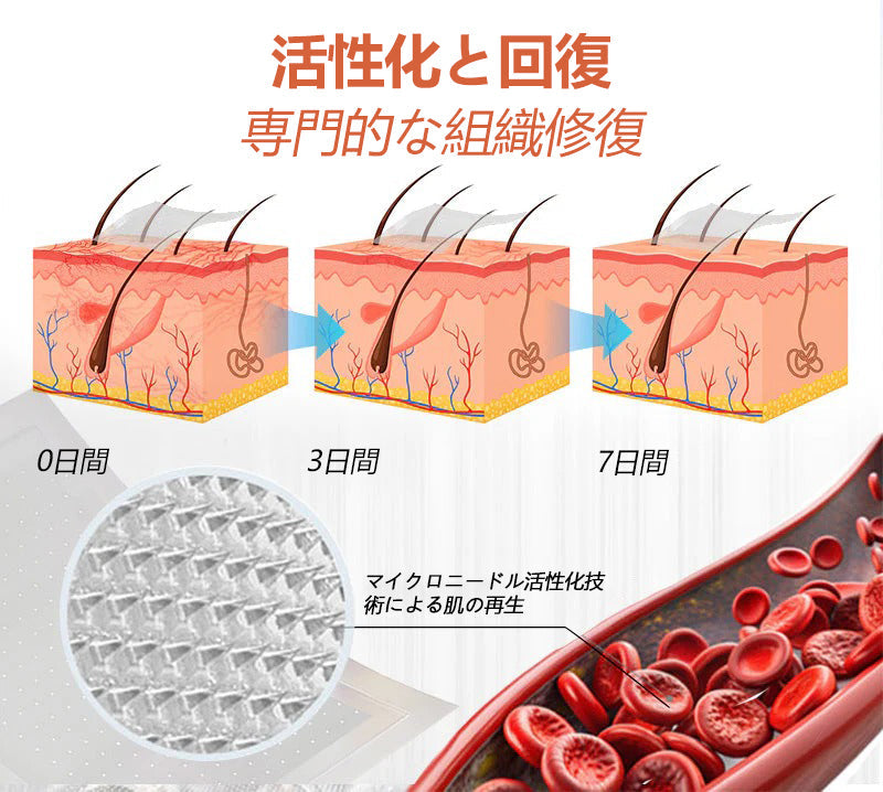 ☘️【厚生労働省認可・GMP準拠】Zvoevo® Vein Ease マイクロニードルケアパッチ（クモ状静脈・静脈瘤・むくみ・脚の疲れに）-  🎯